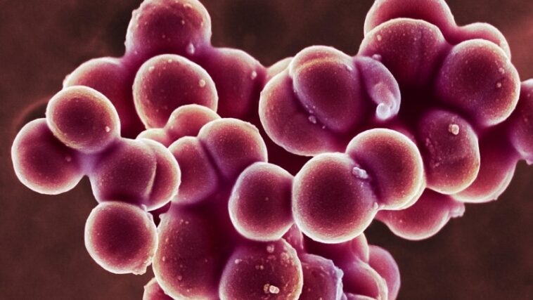 Les bactéries staphiques sont mauvaises pour laisser aller