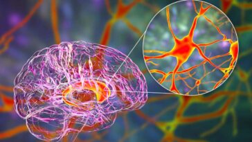 Percée de la maladie de Huntington: que savoir sur la thérapie génique