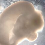 Comment les organeïdes cérébraux révèlent ce qui rend vraiment les humains uniques