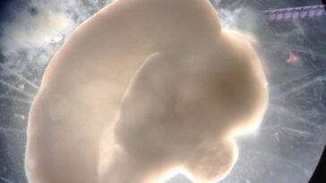 Comment les organeïdes cérébraux révèlent ce qui rend vraiment les humains uniques