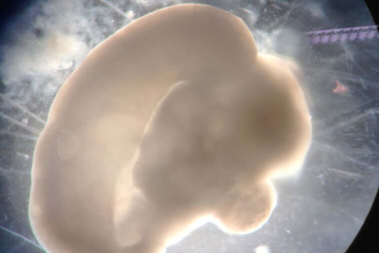 Comment les organeïdes cérébraux révèlent ce qui rend vraiment les humains uniques