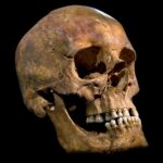 Le microbiome oral du roi Richard III laisse entendre qu'il souffrait d'une grave maladie des gencives The skull of King Richard III