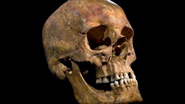 The skull of King Richard III