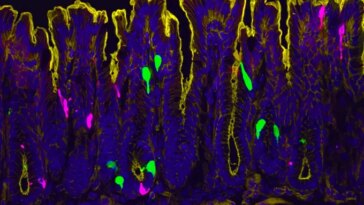 Une tranche de côlon de souris apparaît en violet, avec les bords du tissu soulignés en jaune. Il y a aussi des taches vert vif et rose. Les couleurs désignent les joueurs dans une voie de douleur nouvellement découverte.