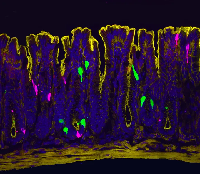 Une tranche de côlon de souris apparaît en violet, avec les bords du tissu soulignés en jaune. Il y a aussi des taches vert vif et rose. Les couleurs désignent les joueurs dans une voie de douleur nouvellement découverte.