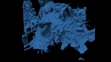 Regardez une cellule cancéreuse échapper à la capture