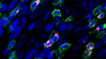 Un vaccin thérapeutique contre le VPH a réduit les tumeurs du col de l'utérus chez la souris