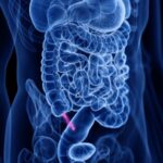 Les antibiotiques peuvent traiter l’appendicite chez de nombreux patients, sans intervention chirurgicale