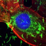 Image microscopique montrant une cellule cancéreuse du sein envahie par des bactéries en forme de bâtonnet.