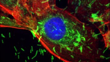 Image microscopique montrant une cellule cancéreuse du sein envahie par des bactéries en forme de bâtonnet.