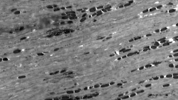 Un grossissement 600 fois des mélanosomes d'un chacal doré.