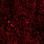 Lymphatic-like structures within the brain of a healthy person