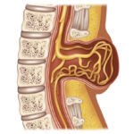 Une illustration du spina bifida.