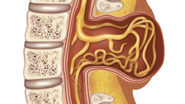 Une illustration du spina bifida.