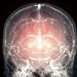 Un grand pas vers la réanimation après la mort grâce à la préservation du cerveau d'un mammifère