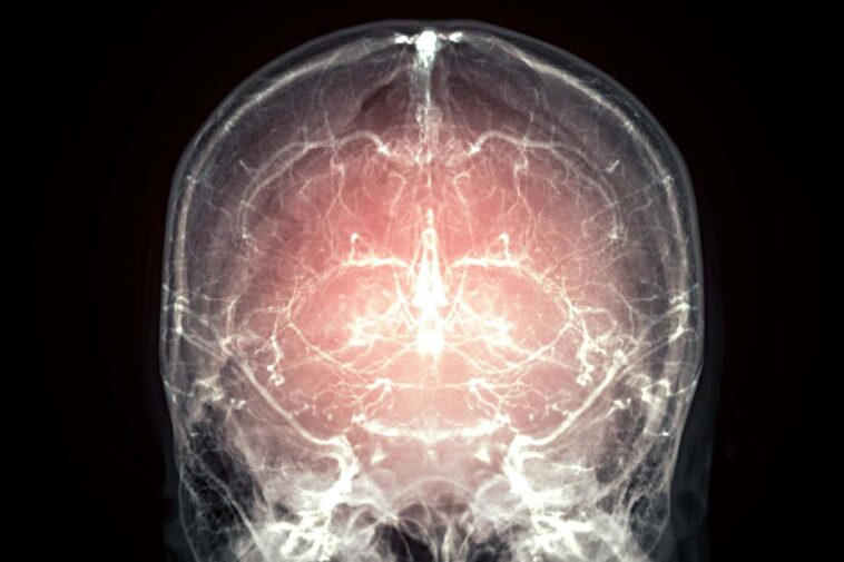 Un grand pas vers la réanimation après la mort grâce à la préservation du cerveau d'un mammifère