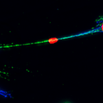 L'ADN endommagé peut se propager entre les cellules humaines. Qu’est-ce que cela pourrait signifier pour le cancer ? L'ADN endommagé peut se propager entre les cellules humaines. Qu’est-ce que cela pourrait signifier pour le cancer ?