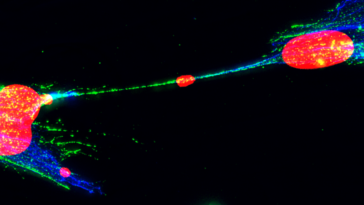 L'ADN endommagé peut se propager entre les cellules humaines. Qu’est-ce que cela pourrait signifier pour le cancer ?
