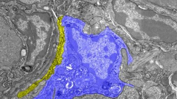 Ce gros plan des cellules immunitaires du foie de pigeon montre une zone en bleu, indiquant que les cellules sont remplies de fer. Une étroite ligne jaune, désignant les nerfs, s'incurve le long d'un côté de la tache bleue. Le reste de l’image est constitué de différents tons de gris.