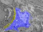Ce gros plan des cellules immunitaires du foie de pigeon montre une zone en bleu, indiquant que les cellules sont remplies de fer. Une étroite ligne jaune, désignant les nerfs, s'incurve le long d'un côté de la tache bleue. Le reste de l’image est constitué de différents tons de gris.