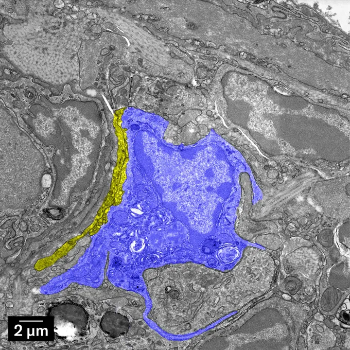 Les pigeons voyageurs pourraient utiliser un mécanisme de navigation surprenant Ce gros plan des cellules immunitaires du foie de pigeon montre une zone en bleu, indiquant que les cellules sont remplies de fer. Une étroite ligne jaune, désignant les nerfs, s'incurve le long d'un côté de la tache bleue. Le reste de l’image est constitué de différents tons de gris.
