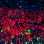 Pourquoi certaines cellules cérébrales sont particulièrement vulnérables à la sclérose en plaques