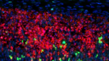Pourquoi certaines cellules cérébrales sont particulièrement vulnérables à la sclérose en plaques