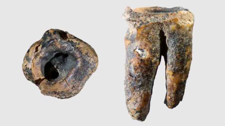 Première preuve de la dentisterie néandertalienne découverte dans une ancienne molaire