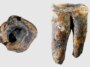 Première preuve de la dentisterie néandertalienne découverte dans une ancienne molaire