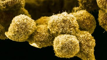 Une nouvelle pilule contre le cancer du pancréas pourrait changer la donne pour les patients