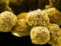 Une nouvelle pilule contre le cancer du pancréas pourrait changer la donne pour les patients