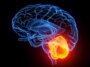 Le « petit cerveau » pourrait donner un grand coup de pouce à l’esprit vieillissant