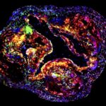 Le sommeil et l'exercice peuvent atténuer les facteurs génétiques des maladies cardiaques