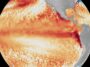 Un « Super El Niño » pourrait être en route. Qu'est-ce que cela signifie?