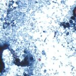 Dans la lutte contre le parasite Cyclospora