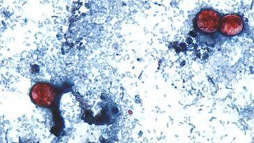 Dans la lutte contre le parasite Cyclospora