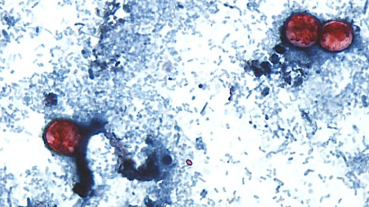 Dans la lutte contre le parasite Cyclospora