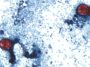 Dans la lutte contre le parasite Cyclospora