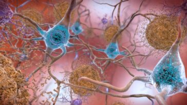 Un nouveau type de médicament contre la maladie d'Alzheimer semble prometteur