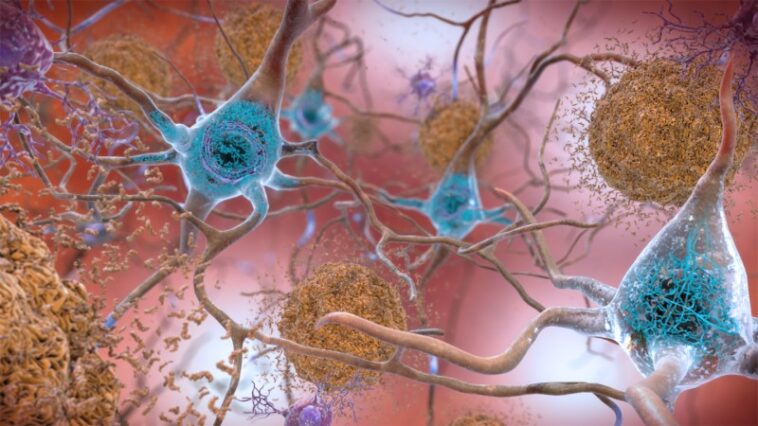 Un nouveau type de médicament contre la maladie d'Alzheimer semble prometteur Un nouveau type de médicament contre la maladie d'Alzheimer semble prometteur