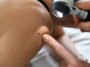 Un nouveau vaccin contre le cancer pourrait empêcher la récidive du mélanome