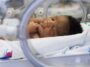 Un scanner basé sur la lumière pourrait détecter une maladie intestinale mortelle chez les bébés prématurés
