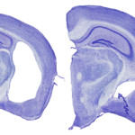 Deux tranches de cerveau de souris colorées en violet sont placées côte à côte. Celui de gauche présente une énorme lacune, signe de dommages semblables à ceux de la maladie d'Alzheimer.
