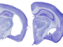 Deux tranches de cerveau de souris colorées en violet sont placées côte à côte. Celui de gauche présente une énorme lacune, signe de dommages semblables à ceux de la maladie d'Alzheimer.