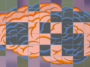 Une étude massive dévoile les fondements génétiques de la fibromyalgie