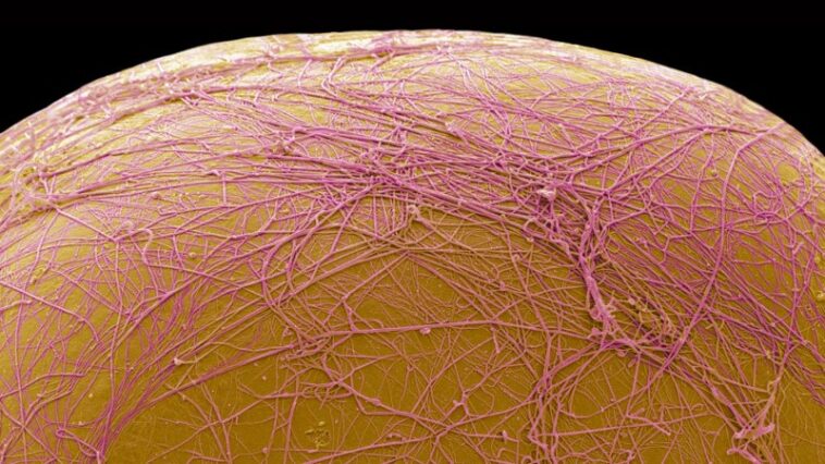 Un médicament expérimental tue les cellules graisseuses au lieu de les réduire Un médicament expérimental tue les cellules graisseuses au lieu de les réduire