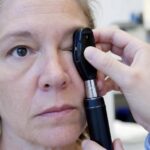 Ce tremblement de la paupière quʼon met sur le compte de la fatigue mérite parfois un vrai examen